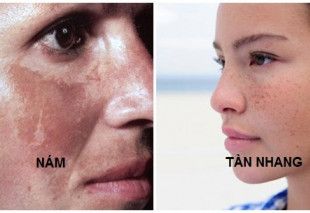 Kem trị nám Kami Skin Anti Melasma Cream K3 có tốt không?